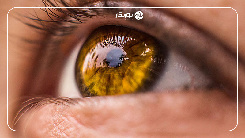 -5 استفاده از بازتاب در عکاسی از چشم