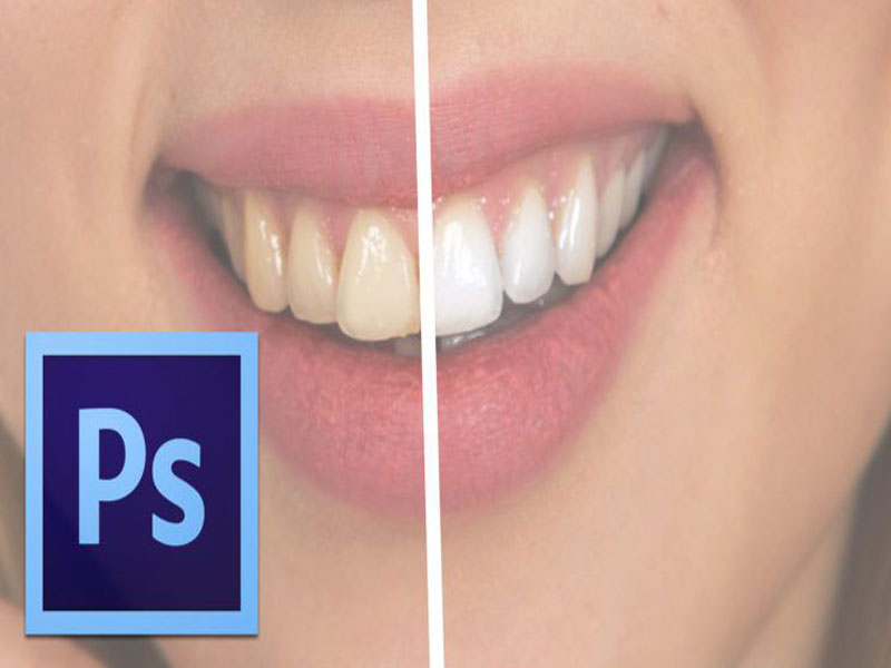 آموزش سفید کردن دندان‌ها در فتوشاپ