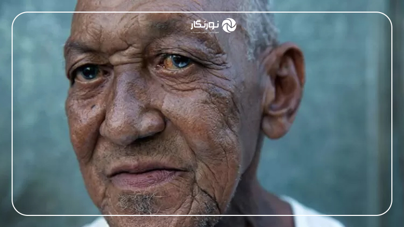 جهت نور در عکاسی؛ کنترل نور طبیعی