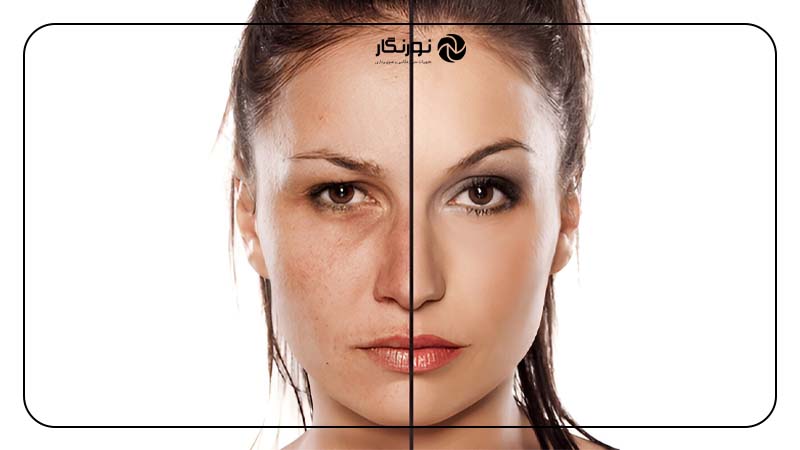 نکات مهم ویرایش چهره در آموزش روتوش پوست صورت