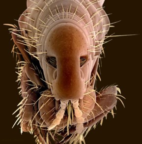 میکروب از نگاه  میکروسکپ