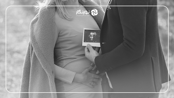 عکس‌های سیاه و سفید دوران بارداری