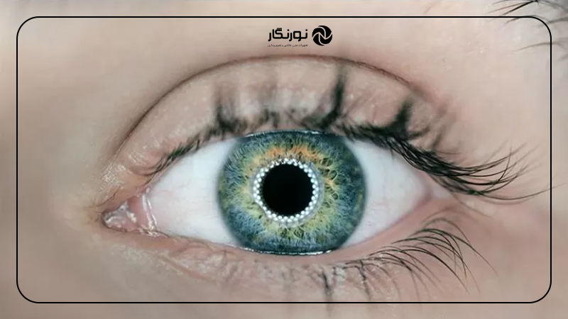 فوکوس نکردن دوربین در تصاویر ماکرو و کلوزآپ