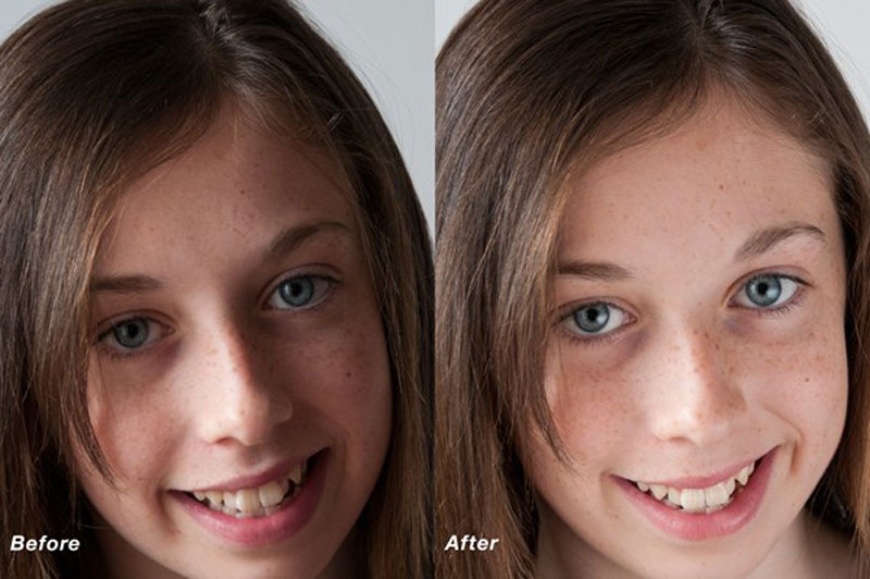 ساخت رفلکتور