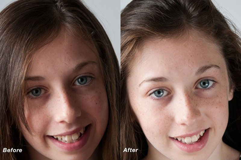 آموزش ساخت رفلکتور