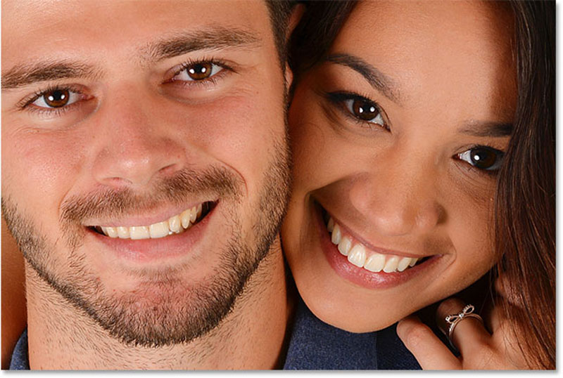 سفید کردن دندان در فتوشاپ