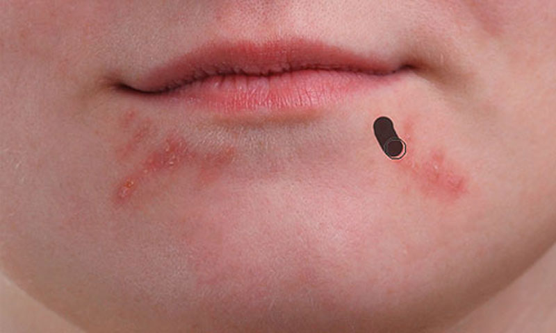 رفع جوش در فتوشاپ