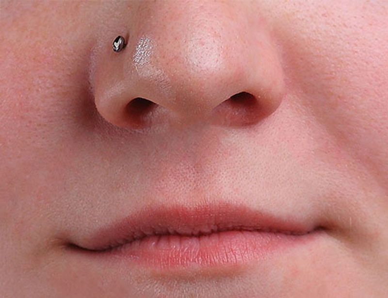 رفع جوش در فتوشاپ