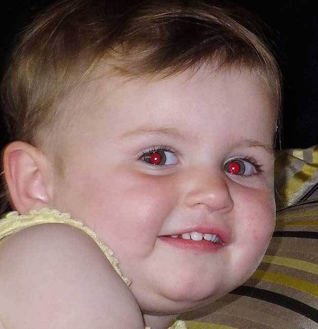 از بین بدن قرمزی جشم به وسیله اسپیدلایت