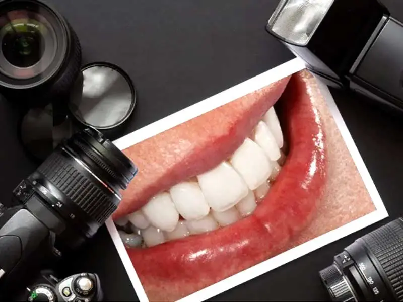 آموزش عکاسی دندانپزشکی | صفر تا صد تکنیک‌ها و تجهیزات + ویدئو